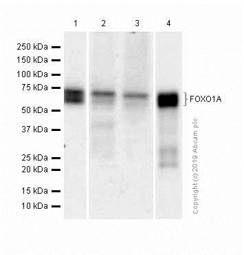 Western blot - Anti-FOXO1A antibody [EPR12020] - BSA and Azide free (AB240212), expandable thumbnail