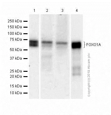 Western blot - Anti-FOXO1A antibody [EPR12020] - BSA and Azide free (AB240212)