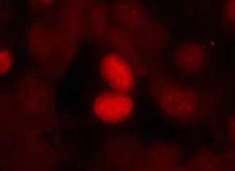 Immunocytochemistry/ Immunofluorescence - Anti-FOXO1A (phospho S256) antibody (AB131339)