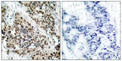 Immunohistochemistry (Formalin/PFA-fixed paraffin-embedded sections) - Anti-FOXO1A (phospho S256) antibody (AB131339)