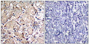Immunohistochemistry (Formalin/PFA-fixed paraffin-embedded sections) - Anti-FOXO1A (phospho S319) antibody (AB47326)