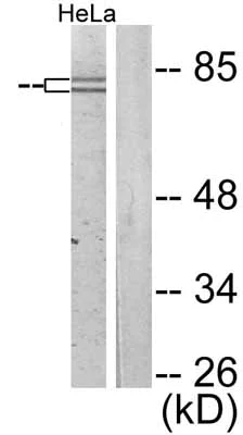Western blot - Anti-FOXO1A (phospho S319) antibody (AB47326)