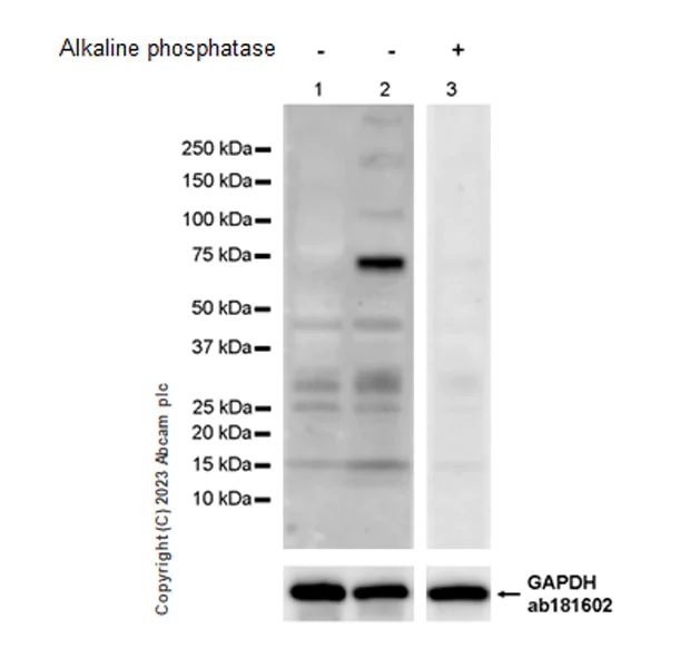 Western blot - Anti-FOXO1A (pT24)+FOXO3A (pT32)+FOXO4 (pT28)+FOXO6 (pT26) antibody [EPR28359-78] (AB312326)