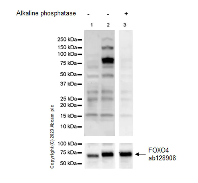 Western blot - Anti-FOXO1A (pT24)+FOXO3A (pT32)+FOXO4 (pT28)+FOXO6 (pT26) antibody [EPR28359-78] (AB312326)