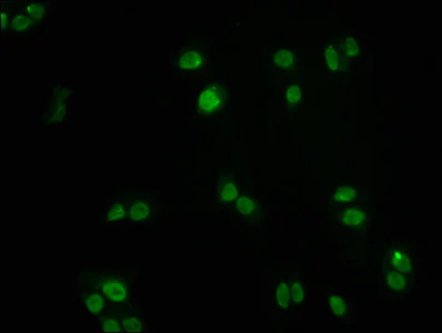 Immunocytochemistry/ Immunofluorescence - Anti-FOXO3A antibody [1E2] (AB314007)