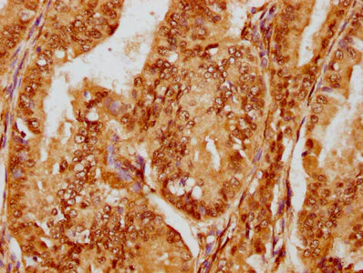 Immunohistochemistry (Formalin/PFA-fixed paraffin-embedded sections) - Anti-FOXO3A antibody [1E2] (AB314007)