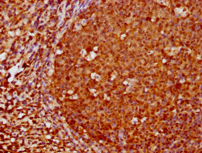 Immunohistochemistry (Formalin/PFA-fixed paraffin-embedded sections) - Anti-FOXO3A antibody [1E2] (AB314007)