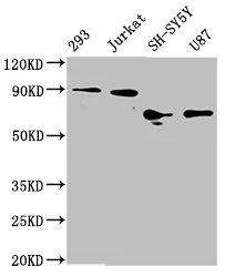 Western blot - Anti-FOXO3A antibody [1E2] (AB314007)
