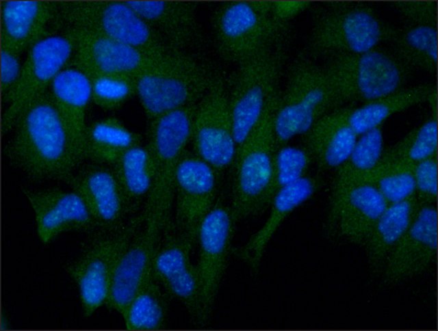 Immunocytochemistry/ Immunofluorescence - Anti-FOXO3A antibody (AB12162)