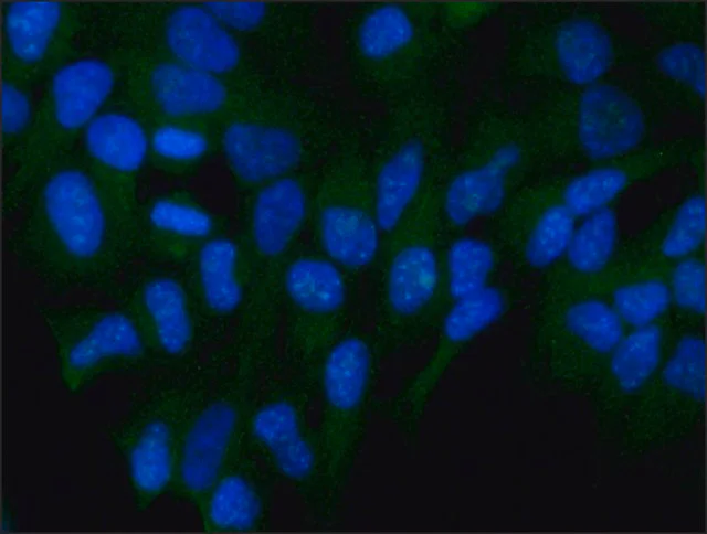 Immunocytochemistry/ Immunofluorescence - Anti-FOXO3A antibody (AB12162)