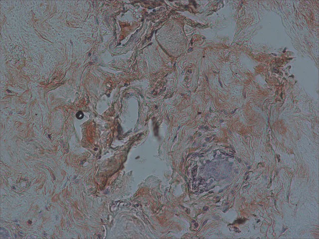Immunohistochemistry (Formalin/PFA-fixed paraffin-embedded sections) - Anti-FOXO3A antibody (AB12162)