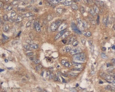 Immunohistochemistry (Formalin/PFA-fixed paraffin-embedded sections) - Anti-FOXO3A antibody (AB12162)