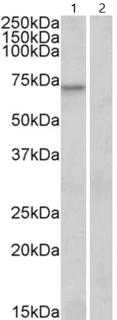 Western blot - Anti-FOXO3A antibody (AB17026)
