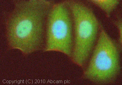 Immunocytochemistry/ Immunofluorescence - Anti-FOXO3A antibody (AB23683)
