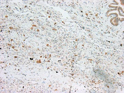 Immunohistochemistry (Formalin/PFA-fixed paraffin-embedded sections) - Anti-FOXO3A antibody (AB23683)