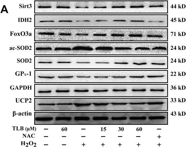 Western blot - Anti-FOXO3A antibody (AB23683)