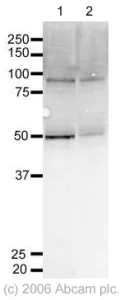 Western blot - Anti-FOXO3A antibody (AB23683)