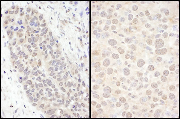 Immunohistochemistry (Formalin/PFA-fixed paraffin-embedded sections) - Anti-FOXO3A antibody (AB70314), expandable thumbnail