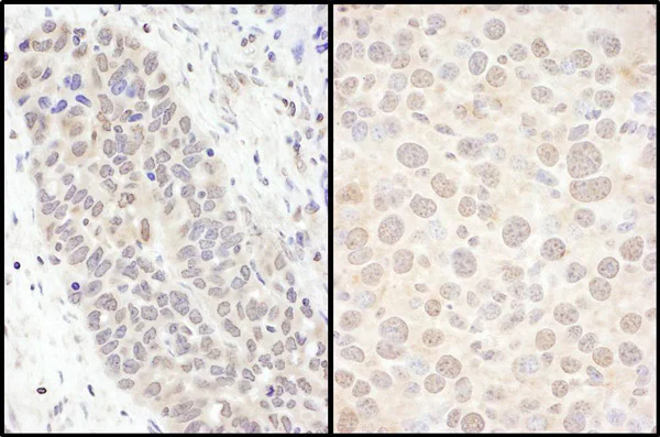 Immunohistochemistry (Formalin/PFA-fixed paraffin-embedded sections) - Anti-FOXO3A antibody (AB70314)