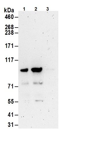Immunoprecipitation - Anti-FOXO3A antibody (AB70314), expandable thumbnail