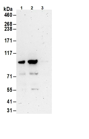 Immunoprecipitation - Anti-FOXO3A antibody (AB70314)