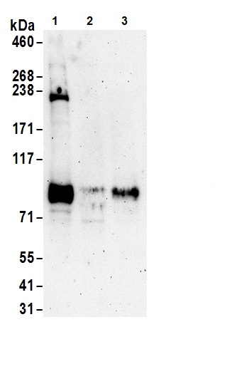 Western blot - Anti-FOXO3A antibody (AB70314), expandable thumbnail