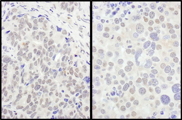 Immunohistochemistry (Formalin/PFA-fixed paraffin-embedded sections) - Anti-FOXO3A antibody (AB70315)