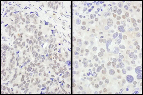 Immunohistochemistry (Formalin/PFA-fixed paraffin-embedded sections) - Anti-FOXO3A antibody (AB70315)
