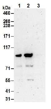 Immunoprecipitation - Anti-FOXO3A antibody (AB70315)
