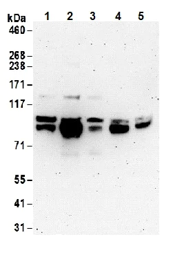 Western blot - Anti-FOXO3A antibody (AB70315)