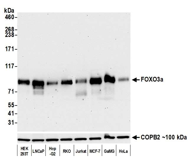 Western blot - Anti-FOXO3a antibody [BLR140H] - BSA free (AB314087), expandable thumbnail