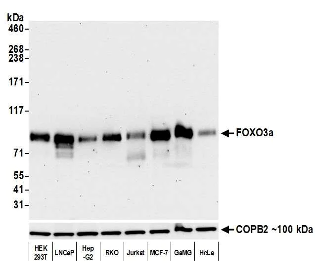 Western blot - Anti-FOXO3a antibody [BLR140H] - BSA free (AB314087)