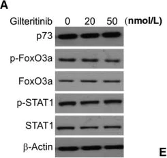 Western blot - Anti-FOXO3A antibody [EPR1950] (AB109629)
