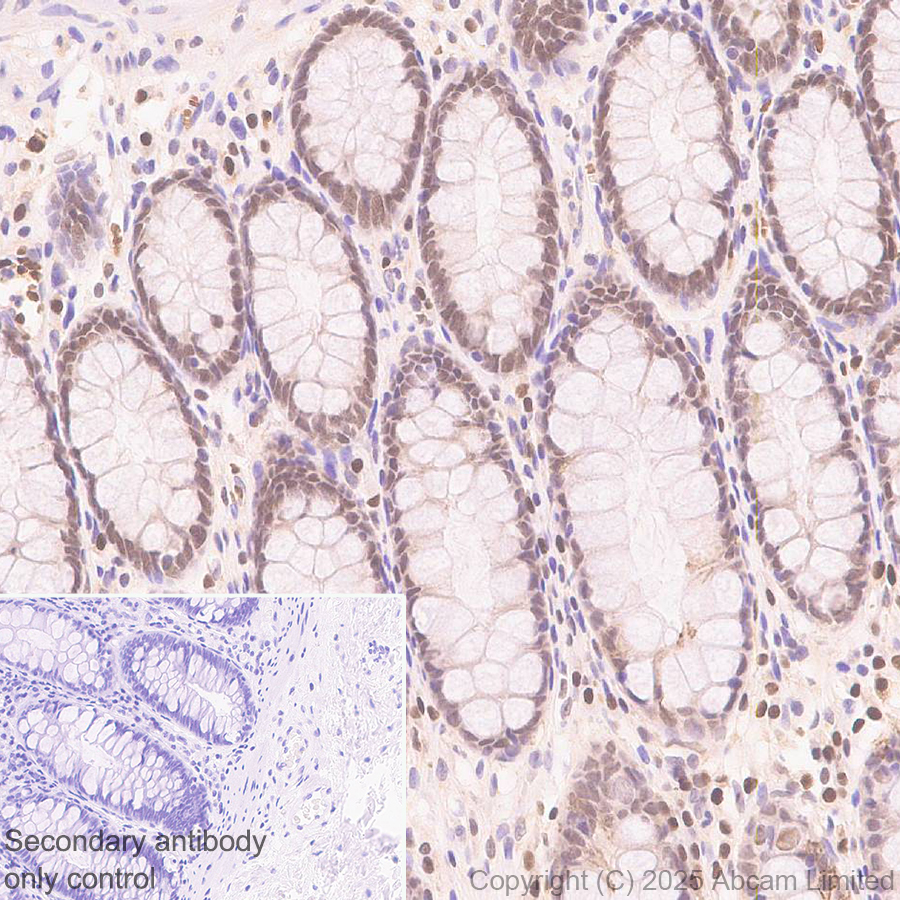 Immunohistochemistry (Formalin/PFA-fixed paraffin-embedded sections) - Anti-FOXO3A antibody [EPR29854-587] (AB323467), expandable thumbnail