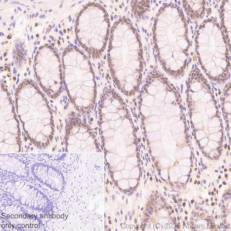 Immunohistochemistry (Formalin/PFA-fixed paraffin-embedded sections) - Anti-FOXO3A antibody [EPR29854-587] (AB323467)