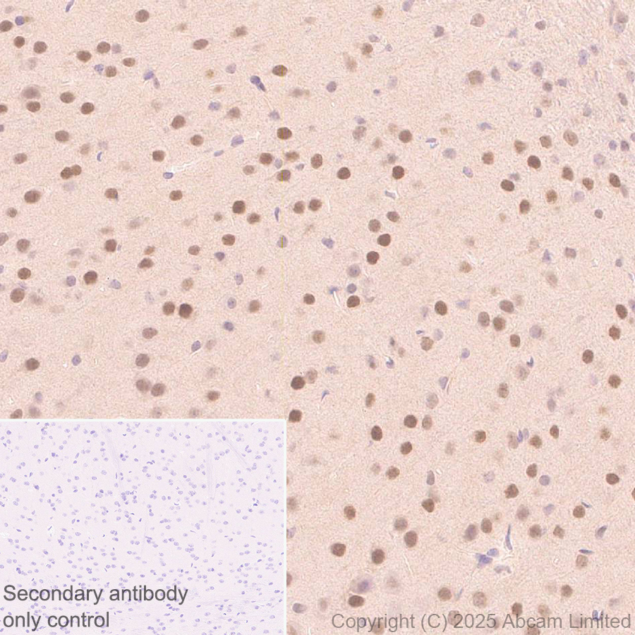 Immunohistochemistry (Formalin/PFA-fixed paraffin-embedded sections) - Anti-FOXO3A antibody [EPR29854-587] (AB323467), expandable thumbnail