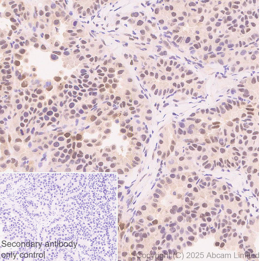 Immunohistochemistry (Formalin/PFA-fixed paraffin-embedded sections) - Anti-FOXO3A antibody [EPR29854-587] (AB323467), expandable thumbnail