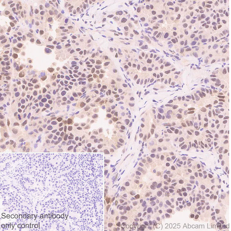 Immunohistochemistry (Formalin/PFA-fixed paraffin-embedded sections) - Anti-FOXO3A antibody [EPR29854-587] (AB323467)