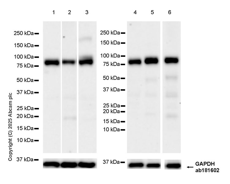 Western blot - Anti-FOXO3A antibody [EPR29854-587] (AB323467), expandable thumbnail