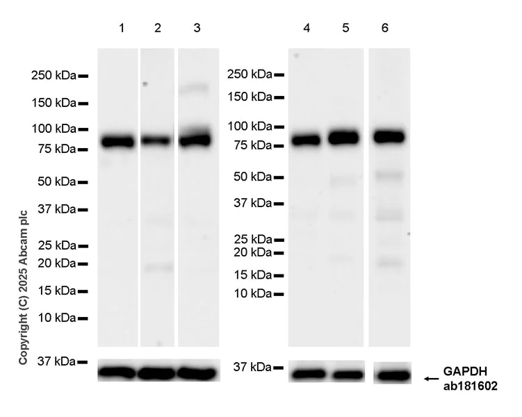 Western blot - Anti-FOXO3A antibody [EPR29854-587] (AB323467)