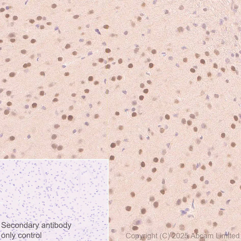 Immunohistochemistry (Formalin/PFA-fixed paraffin-embedded sections) - Anti-FOXO3A antibody [EPR29854-587] - BSA and Azide free (AB325946)