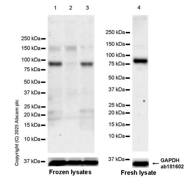 Western blot - Anti-FOXO3A antibody [EPR29854-587] - BSA and Azide free (AB325946)