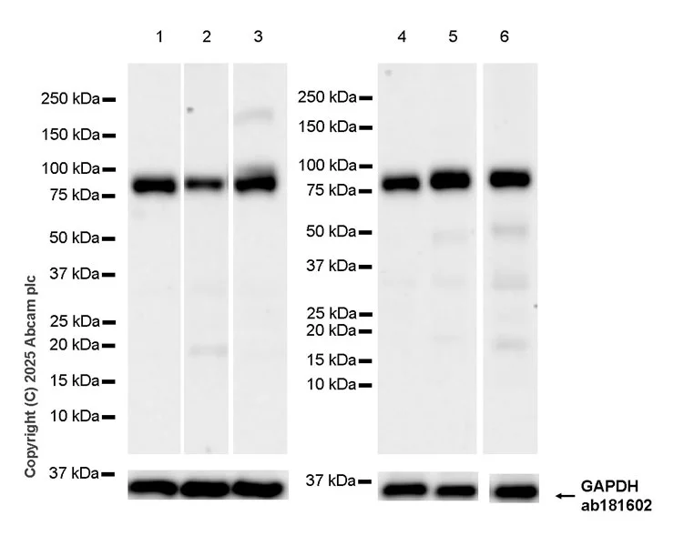 Western blot - Anti-FOXO3A antibody [EPR29854-587] - BSA and Azide free (AB325946)
