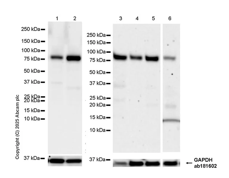 Western blot - Anti-FOXO3A antibody [EPR29854-587] - BSA and Azide free (AB325946)