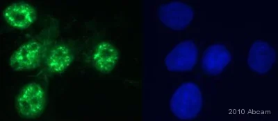 Immunocytochemistry/ Immunofluorescence - Anti-FOXO3A (phospho S253) antibody (AB47285)