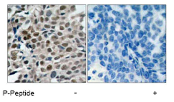 Immunohistochemistry (Formalin/PFA-fixed paraffin-embedded sections) - Anti-FOXO3A (phospho S253) antibody (AB47285)