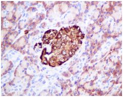 Immunohistochemistry (Formalin/PFA-fixed paraffin-embedded sections) - Anti-FOXO3A (phospho S253) antibody [EPR1951(2)] (AB154786)