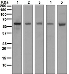 Western blot - Anti-FOXO4/AFX antibody [EPR5442] (AB128908), expandable thumbnail
