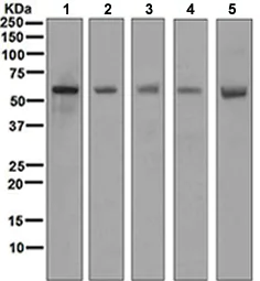 Western blot - Anti-FOXO4/AFX antibody [EPR5442] (AB128908)
