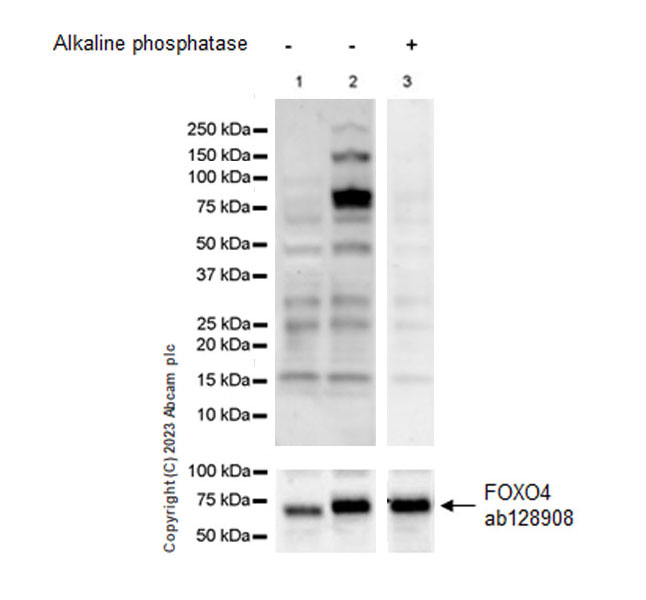 Western blot - Anti-FOXO4/AFX antibody [EPR5442] (ab128908), expandable thumbnail